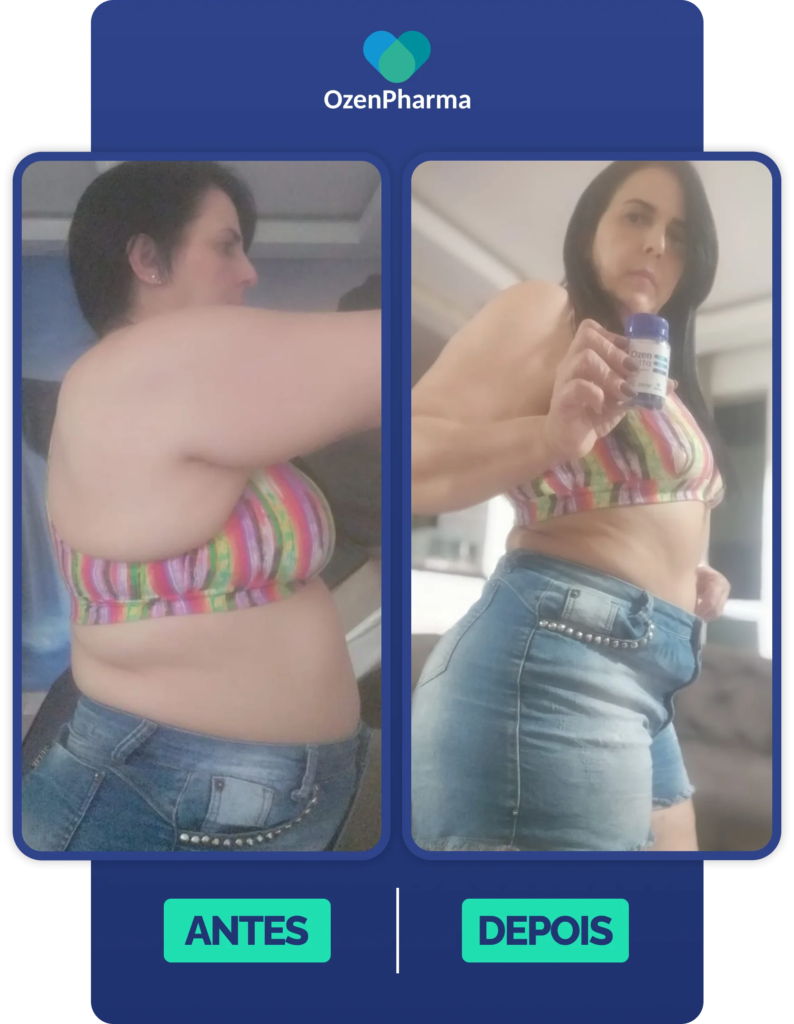 Comparativo de antes e depois mostrando redução de gordura abdominal após tratamento com OzenVitta.