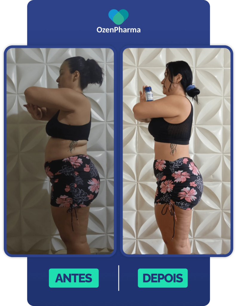 Redução de medidas na barriga e cintura após tratamento com OzenVitta, evidenciada em fotos de perfil.